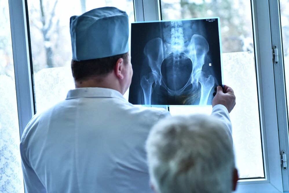 Il medico esamina l'immagine di un'articolazione dell'anca con artrosi
